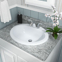 MSI Overmount White Oval 2118 Sinks — surface detail in white tonality